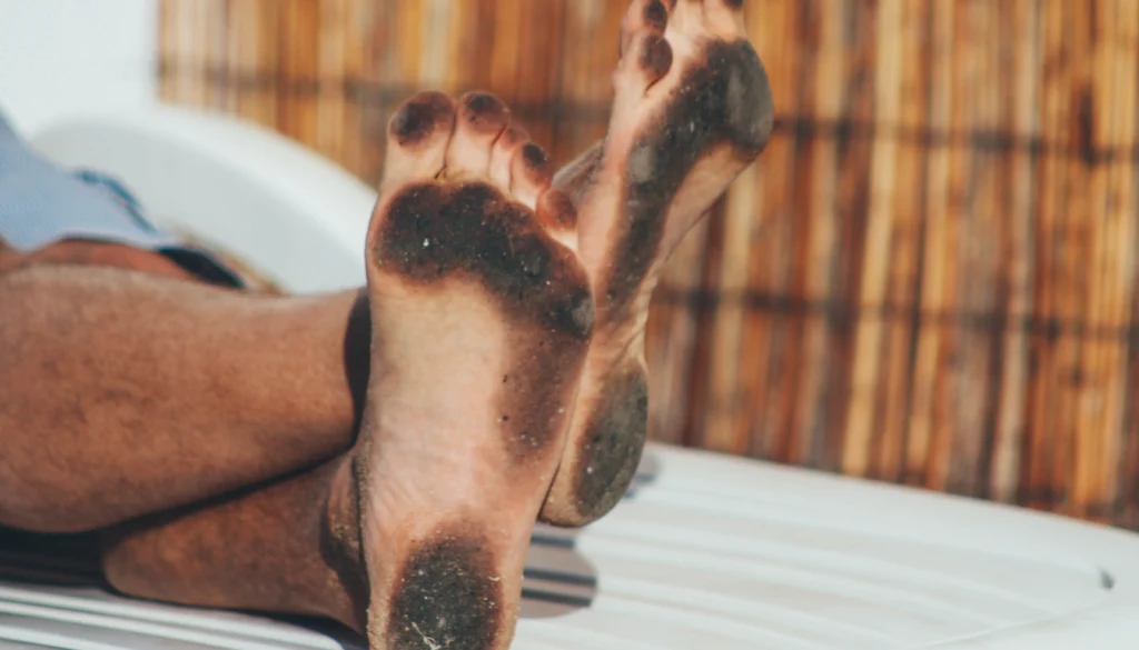 Podiatrist demonstrating a patient with really poor foot hygiene daily foot hygiene and healthy foot care to a patient in Brisbane
